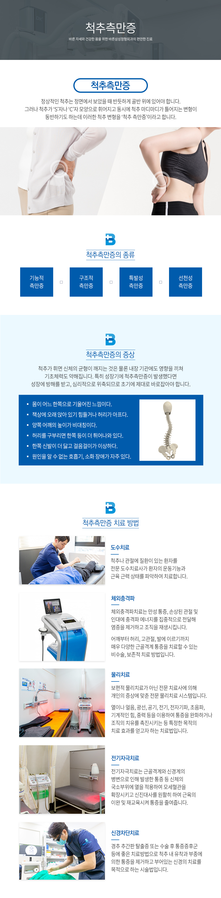 척추측만증